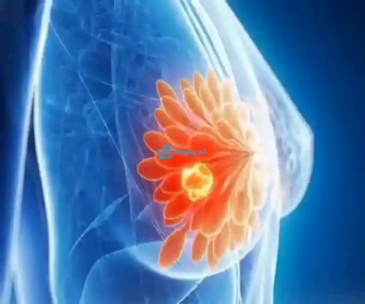 The Estrogen Connection: Unpacking the Silent Risk Factors of Breast Cancer and Proven Natural Defenses.