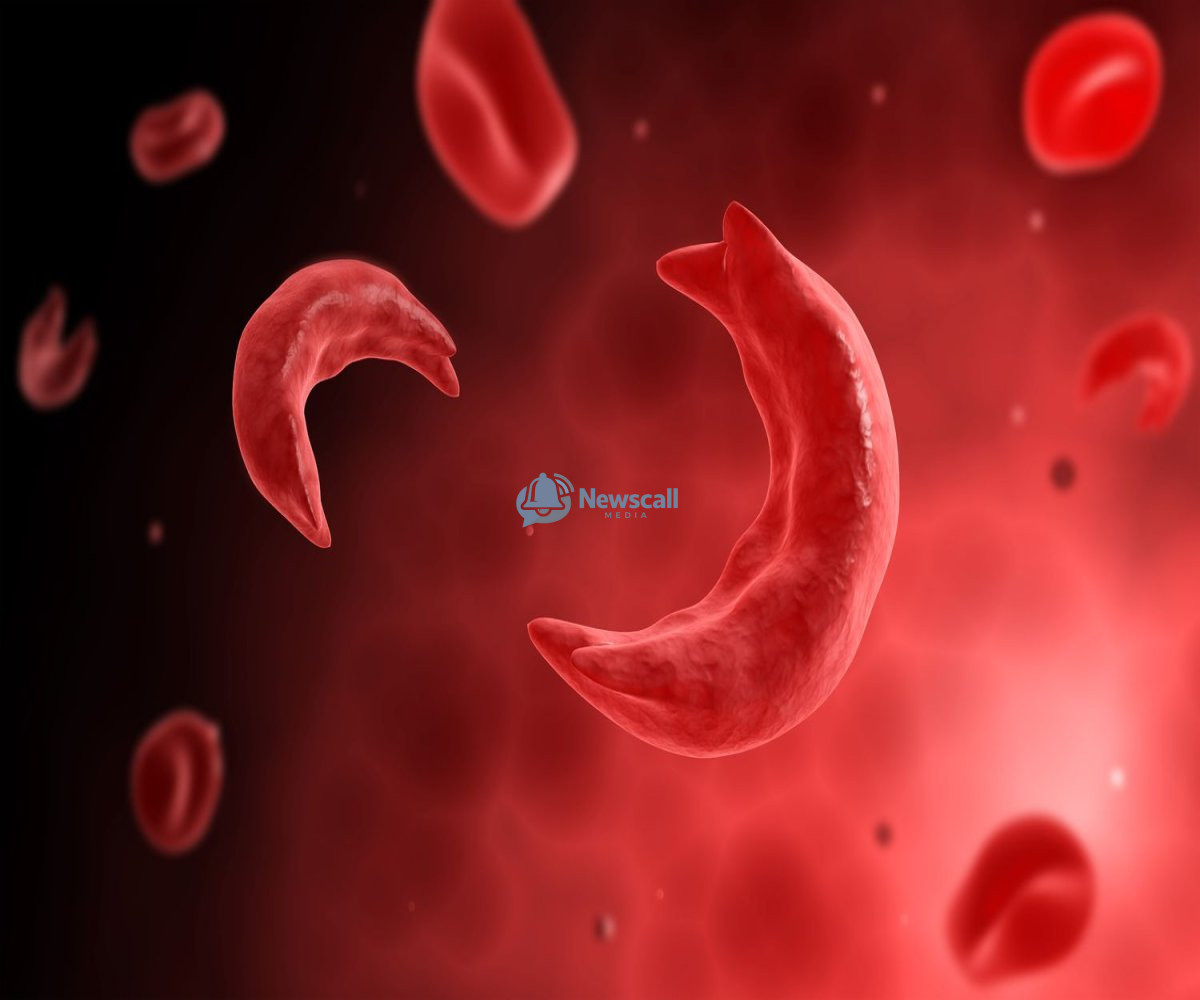 The Pain No One Sees: Sickle Cell Warrior’s Plea to Nigeria – ‘Stop Punishing Us’
